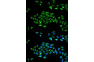 Immunofluorescence analysis of U2OS cells using PCM1 Rabbit pAb (ABIN7269217) at dilution of 1:50,1:100,1:200 (40x lens). (PCM1 抗体  (AA 1-260))