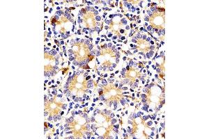 Immunohistochemistry (Paraffin-embedded Sections) (IHC (p)) image for anti-Indoleamine 2,3-Dioxygenase 2 (IDO2) (AA 267-295), (C-Term) antibody (ABIN656340)