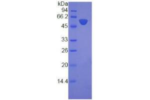 SDS-PAGE analysis of Human Laminin beta 3 Protein. (Laminin beta 3 蛋白)