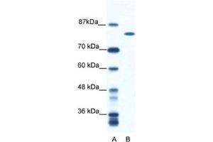 Western Blotting (WB) image for anti-DEAH (Asp-Glu-Ala-His) Box Polypeptide 16 (DHX16) antibody (ABIN2461579) (DHX16 抗体)