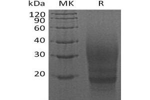 Western Blotting (WB) image for Cytotoxic T-Lymphocyte-Associated Protein 4 (CTLA4) (Active) protein (His tag) (ABIN7321017)