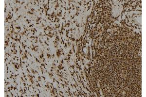 ABIN6277738 at 1/100 staining Human gastric tissue by IHC-P. (Claspin 抗体  (N-Term))