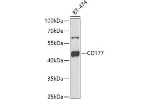 Western blot analysis of extracts of BT-474 cells, using CD177 antibody (ABIN6131282, ABIN6138125, ABIN6138127 and ABIN6222217) at 1:1000 dilution. (CD177 抗体  (AA 35-285))
