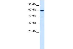 WB Suggested Anti-DACH2 Antibody Titration:  0.