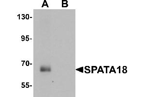 Western blot analysis of SPATA18 in rat lung tissue lysate with SPATA18 antibody at 1 µg/mL in (A) the absence and (B) the presence of blocking peptide (SPATA18 抗体  (N-Term))