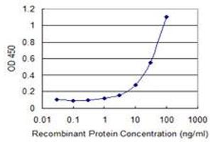 Detection limit for recombinant GST tagged USP6 is 1 ng/ml as a capture antibody. (USP6 抗体  (AA 2-89))
