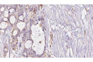 Immunohistochemistry (IHC) image for anti-Nitric Oxide Synthase 1, Neuronal (NOS1) (pSer852) antibody (ABIN6256437)