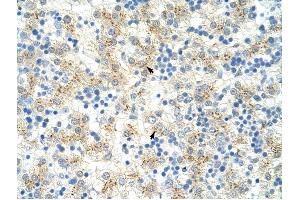 EXOSC6 antibody was used for immunohistochemistry at a concentration of 4-8 ug/ml to stain Hepatocytes (arrows) in Human Liver. (EXOSC6 抗体  (N-Term))