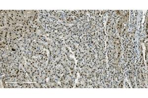 IHC analysis of Transketolase/TKT using anti-Transketolase/TKT antibody (ABIN7598958).