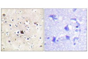 Immunohistochemistry (IHC) image for anti-GR (Internal Region), (pSer234), (Ser226), (Ser246) antibody (ABIN1847938) (GR (Internal Region), (pSer234), (Ser226), (Ser246) 抗体)