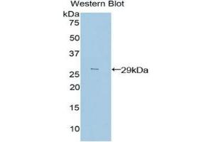 Western Blotting (WB) image for anti-Proto-Oncogene Pim-2 (Serine Threonine Kinase) (PIM2) (AA 98-319) antibody (ABIN1860222) (PIM2 抗体  (AA 98-319))