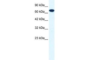 Human HepG2; WB Suggested Anti-ZNF179 Antibody Titration: 0. (RNF112 抗体  (C-Term))