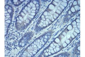 Immunohistochemistry (IHC) image for anti-RAB5A, Member RAS Oncogene Family (RAB5A) (AA 1-215) antibody (ABIN5542375)