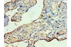 Immunohistochemistry of paraffin-embedded human placenta tissue using ABIN7167479 at dilution of 1:100 (RIPK3 抗体  (AA 1-120))