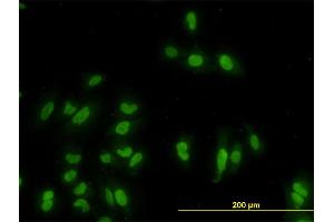 Immunofluorescence of monoclonal antibody to GATA2 on HeLa cell. (GATA2 抗体  (AA 1-102))
