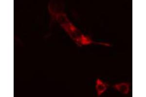 ABIN6266635 staining RAW264. (SNAP25 抗体  (C-Term))