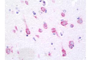 Anti-PRKAA1 + PRKAA2 antibody IHC staining of human brain, cortex.