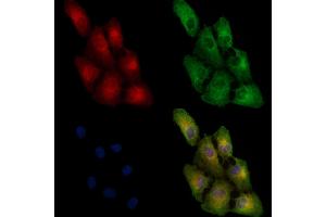 ABIN6257799 and ABIN6274834 staining  cells by IF/ICC. (AASS 抗体  (C-Term))