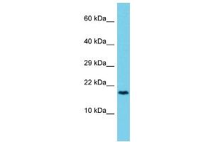 Host: Rabbit Target Name: CCDC12 Sample Type: 721_B Whole Cell lysates Antibody Dilution: 1. (CCDC12 抗体  (C-Term))