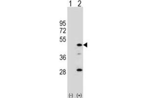Western Blotting (WB) image for anti-Arylacetamide Deacetylase (Esterase) (AADAC) antibody (ABIN3002812) (AADAC 抗体)