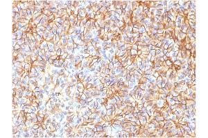 Formalin-fixed, paraffin-embedded human Pancreas stained with Spectrin beta III Monoclonal Antibody (SPTBN2/1584). (Spectrin, Beta, Non-erythrocytic 2 (SPTBN2) (AA 356-475) 抗体)
