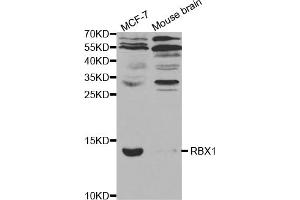 Western blot analysis of extracts of various cell lines, using RBX1 antibody. (RBX1 抗体)