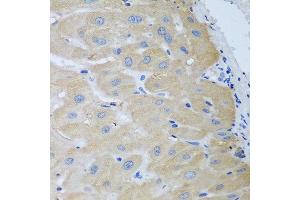 Immunohistochemistry of paraffin-embedded human liver using NME4 antibody at dilution of 1:100 (40x lens). (NME4 抗体)