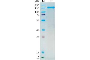 SDS-PAGE (SDS) image for Folate Hydrolase (Prostate-Specific Membrane Antigen) 1 (FOLH1) protein (mFc Tag) (ABIN7092711)