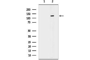 Western blot analysis of lysates from HepG2 cells(H2O2 treatment), using Phospho-HDAC5 (Ser259) Antibody.