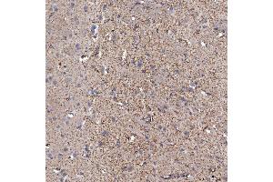 IHC analysis of SFXN5 using anti-SFXN5 antibody (ABIN7601388). (Sideroflexin 5 抗体  (AA 34-340))