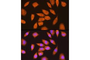 Immunofluorescence analysis of L929 cells using LY6E Rabbit pAb (ABIN6131998, ABIN6143391, ABIN6143392 and ABIN6214390) at dilution of 1:100 (40x lens). (LY6E 抗体  (AA 21-101))