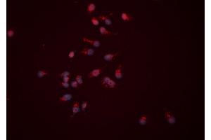 ABIN6276522 staining HEPG2 cells by ICC/IF. (APEX1 抗体  (N-Term))