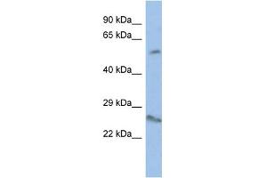 WB Suggested Anti-VENTX Antibody Titration:  0. (VENTX 抗体  (Middle Region))