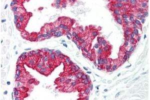 Human Prostate (formalin-fixed, paraffin-embedded) stained with KRT8 antibody ABIN292229 at 20 ug/ml followed by biotinylated anti-mouse IgG secondary antibody ABIN481714, alkaline phosphatase-streptavidin and chromogen. (KRT8 抗体)