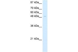 WB Suggested Anti-ZNF70 Antibody Titration:  5. (ZNF70 抗体  (C-Term))