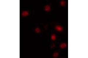 ABIN6274283 staining HuvEc cells by IF/ICC. (RBM5 抗体  (N-Term))