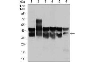 Western blot analysis using CDK2 mouse mAb against Jurkat (1), HL-60 (2), K562(3), A431(4), HeLa(5), and NIH3T3 (6) cell lysate.