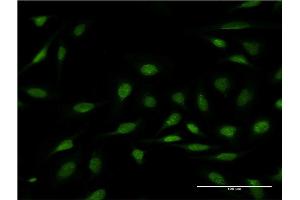 Immunofluorescence of monoclonal antibody to ZNF256 on HeLa cell. (ZNF256 抗体  (AA 521-627))