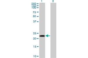 Western Blot analysis of MS4A4A expression in transfected 293T cell line by MS4A4A MaxPab polyclonal antibody. (MS4A4A 抗体  (AA 1-239))