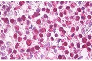 Anti-MCM5 antibody IHC staining of human tonsil. (MCM5 抗体)