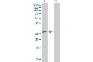 Western Blot analysis of RHOXF1 expression in transfected 293T cell line by RHOXF1 MaxPab polyclonal antibody. (RHOXF1 抗体  (AA 1-184))