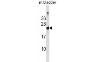 Mouse Hras1 Antibody (C-term) (ABIN1881438 and ABIN2838652) western blot analysis in mouse bladder tissue lysates (35 μg/lane). (HRAS 抗体  (C-Term))