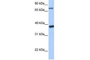 DIDO1 antibody used at 2. (DIDO1 抗体  (C-Term))