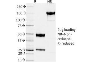 SDS-PAGE Analysis Purified TIMP2 Mouse Monoclonal Antibody (TIMP2/2044). (TIMP2 抗体  (AA 48-220))