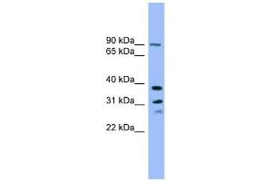 LHPP antibody used at 1 ug/ml to detect target protein. (LHPP 抗体  (Middle Region))