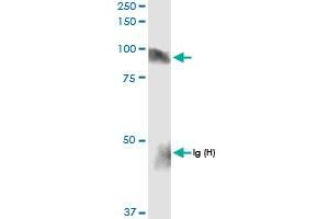 Immunoprecipitation of HLCS transfected lysate using anti-HLCS MaxPab rabbit polyclonal antibody and Protein A Magnetic Bead , and immunoblotted with HLCS MaxPab rabbit polyclonal antibody (D01) . (HLCS 抗体  (AA 1-726))