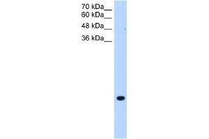 WB Suggested Anti-TMEM75 Antibody Titration:  0. (TMEM75 抗体  (C-Term))