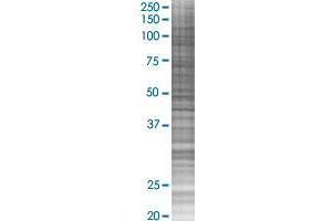 CXCL11 transfected lysate. (CXCL11 293T Cell Transient Overexpression Lysate(Denatured))