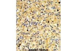 Immunohistochemistry (IHC) image for anti-Coiled-Coil Domain Containing 3 (CCDC3) antibody (ABIN3003893) (CCDC3 抗体)