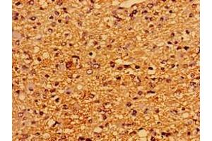 Immunohistochemistry (IHC) image for anti-Protein tyrosine Phosphatase, Receptor-Type, Z Polypeptide 1 (PTPRZ1) (AA 36-300) antibody (ABIN7167523)